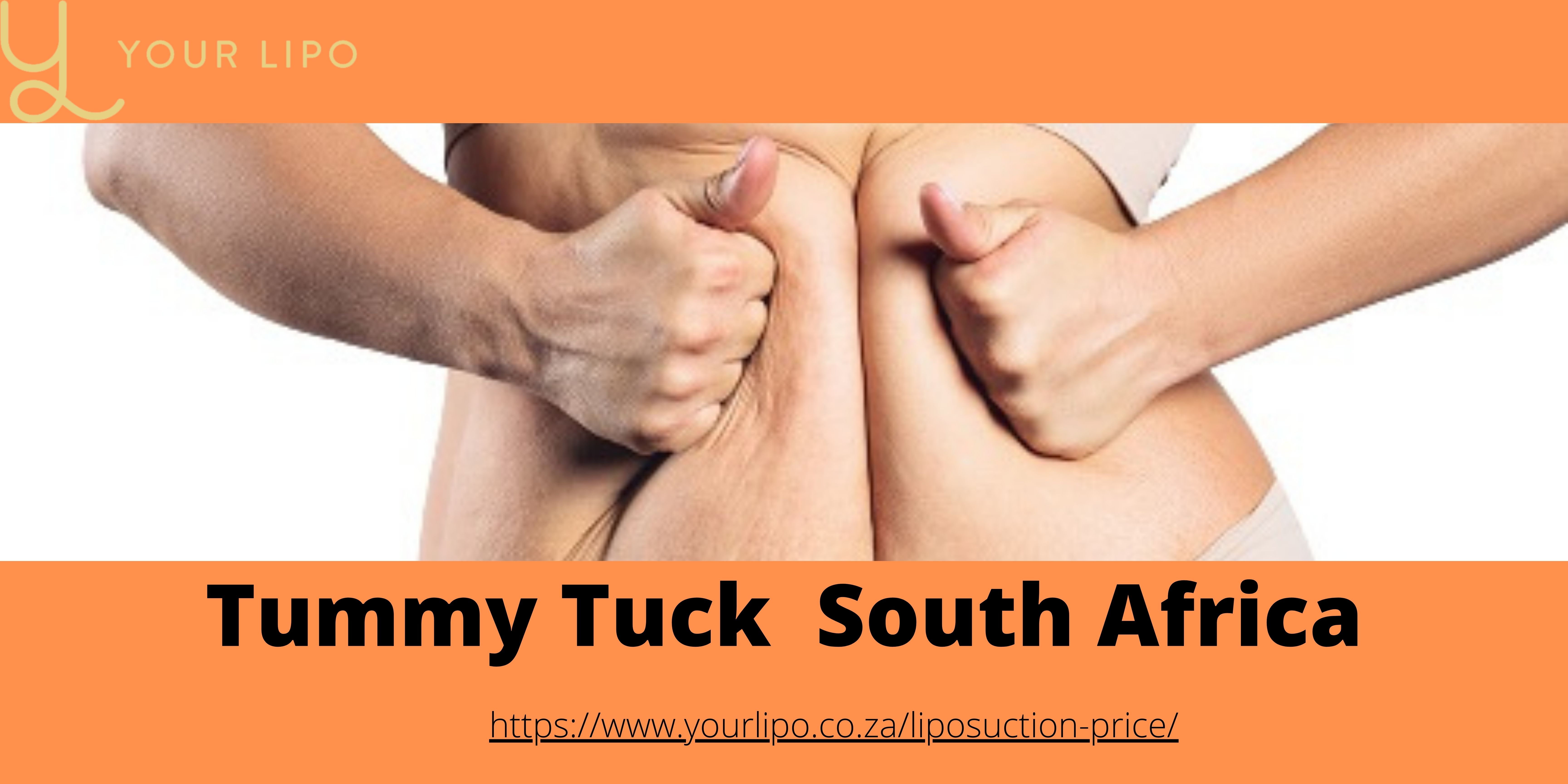 Tummy Tuck South Africa