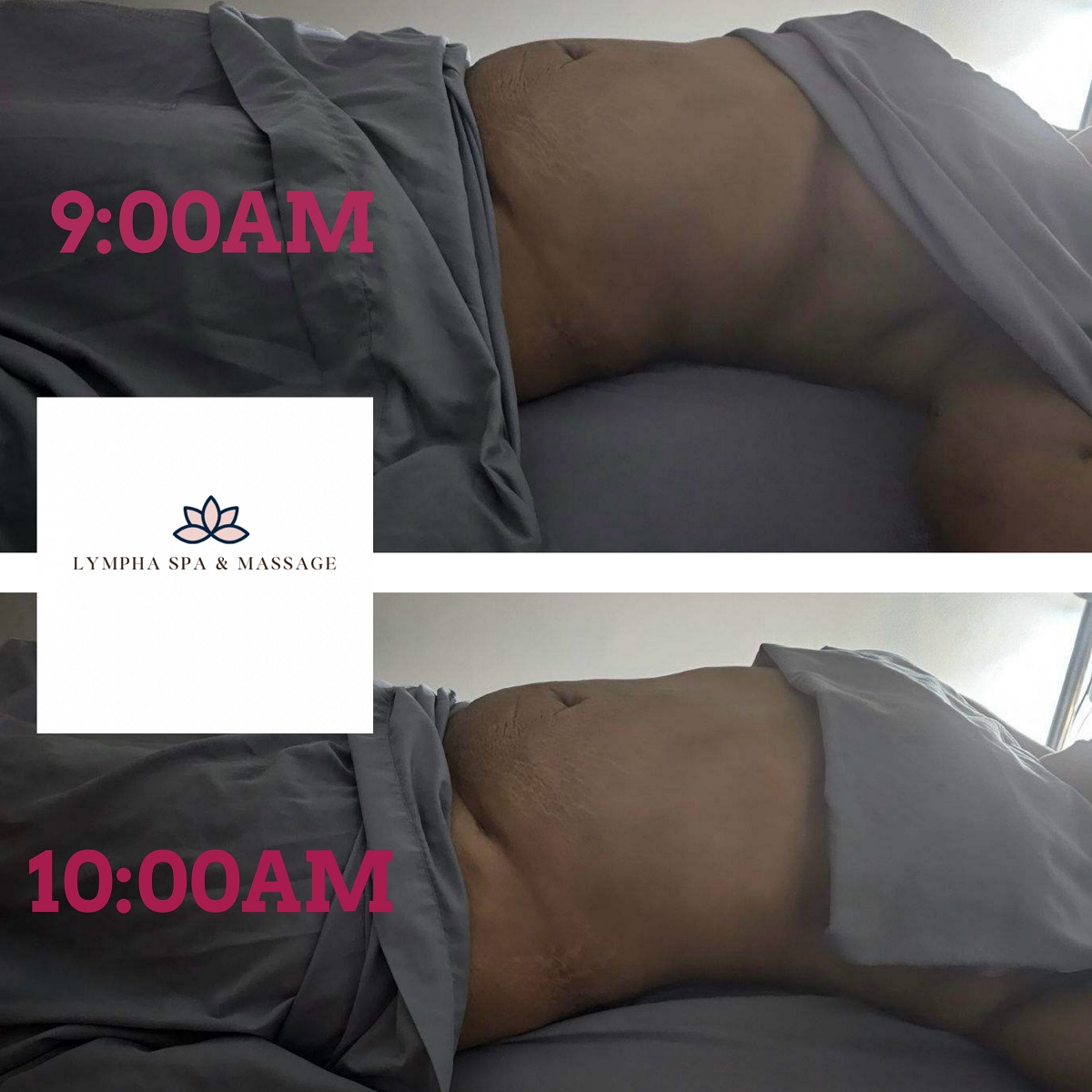 Lymphaspaandmassage